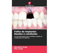 Falha do implante: Razões e condições: Um guia abrangente para a etiologia e gestão de complicações de implantes