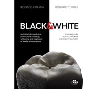 Federico Emiliani Roberto Turrini Black & White (Copertina rigida)