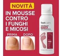 FEETCALM crema in mousse MICOSI FUNGHI UNGHIE alto assorbimento TEA TREE UREA