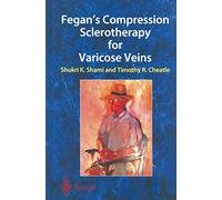 Fegan’s Compression Sclerotherapy for Varicose Veins – Springer Verlag