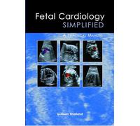 Fetal Cardiology Simplified: A Practical Manual