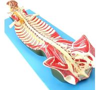 FHSLKXIM Modello Anatomico del Canale Vertebrale della Colonna Vertebrale Umana Che Mostra Le Strutture del Cervello E dei Nervi Spinali nel Canale Vertebrale Utilizzato per L'Insegnamento