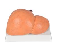 FHUILIJH Modello di Fegato Normale Adulto - Modello Fegato Patologico Completo - Organi Interni Umani in Silicone per Ricerca Medica e Insegnamento,C,26cm