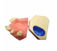 FHUILIJH Modello di impianto Dentale Modello di impianto Dentale per Formazione, insegnamento, dimostrazione e Studio,Flesh,8cm