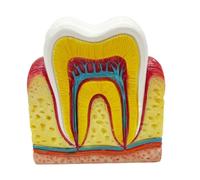 FHUILIJH Modello di visualizzazione della Sezione Trasversale del Dente Sei Volte più Grande - Modello di insegnamento Orale del Nervo Dentale - per l'insegnamento dello Studio,Flesh,8cm