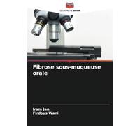 Fibrose sous-muqueuse orale