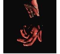 Fischerspooner - Emerge Remixed II