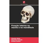 Fixação interna na maxila e na mandíbula
