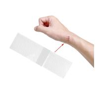 Fogli per cicatrici in silicone Strisce per cicatrici Riparazione della