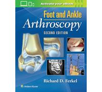 Foot and Ankle Arthroscopy