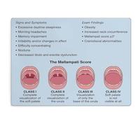 FOPURE Obstructive Sleep Apnea Clinical Signs Poster Canvas Print Wall-Art for Training Classroom Library(Framed,16x24inch(40x60cm))