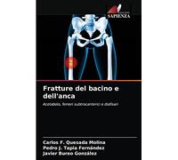 Fratture del bacino e dell'anca: Acetabolo, femori subtrocanterici e diafisari