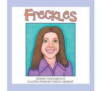 Freckles