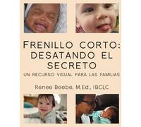Frenillo Corto: Desatando el Secreto: Un recurso visual para las familias