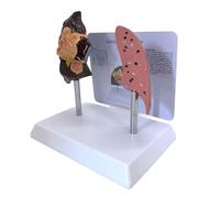 Fumatore anatomico Strumento di dimostrazione polmonare e polmonare PVC Clinico Aiuto didattico per uso in classe Struttura respiratoria Modello di insegnamento