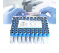 GCLCPAEN Provetta in Plastica per Prelievo di Sangue Sottovuoto, Citrato di Sodio 1:9, Prelievo di Sangue A Pressione Negativa, 2Ml/5Ml/10Ml, Tappo Blu, per Analisi di Laboratorio, 100 Pezzi,5ML
