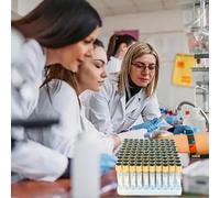 GCLCPAEN Provetta per Coagulazione con Gel di Separazione,Provetta per Raccolta Sangue Sottovuoto in Plastica,3Ml/5Ml/10Ml,Monouso,Tenuta Forte,Pressione Negativa,per Test Sierologici,100pcs,3ml