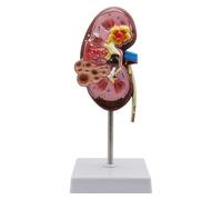 Generico Modello anatomico del Rene Umano, con identificazione Digitale della Posizione Anatomica, for dimostrare la Struttura e la Funzione del Rene Umano