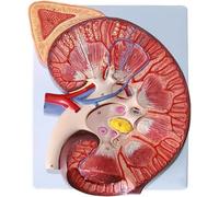 Generico Modello anatomico del rene umano ingrandito 3 volte - include l'anatomia della ghiandola surrenale e dei nefroni per l'ausilio alla formazione educativa medica