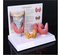 Generico Modello Anatomico della Tiroide, Modello Didattico dell'Anatomia del Corpo Umano Strumento di Insegnamento Modello del Nodulo Tiroideo, 3:1 Che Mostra il Sistema Digestivo Patologico