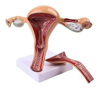 Generico Modello anatomico dell'utero 2 parti Modello anatomico dell'utero Utero Ovar Anatomia della donna umana Modello degli organi riproduttivi femminili