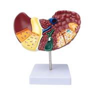 Generico Modello di anatomia del fegato umano con base e struttura chiara e caratteristiche patologiche Modello di cancro al fegato per lo studio di visualizzazione dell'insegnamento