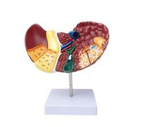 Generico Modello di Anatomia del fegato Umano, Modello anatomico del fegato patologico a grandezza Naturale, Modello di cirrosi epatica dalle Caratteristiche patologiche per Lo Studio