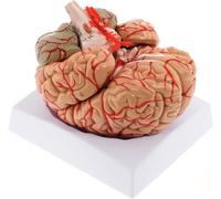 Generico Modello di Arteria Cerebrale Umana - Modello Anatomico del Cervello Umano a Dimensione Naturale, Può Essere Separato in 9 Parti, con Arterie Codificate a Colori, Base di Esposizione