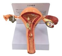 Generico Modello di Utero Patologico - Modello Anatomico del Sistema Riproduttivo Femminile, Modello di Anatomia dell'Utero e delle Ovaie - per l'Educazione all'Anatomia e alla Fisiologia Umana