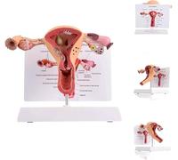 Generico Modello di Utero Umano 3D Modello di ovaio Anatomia Umana Anatomia del Sistema riproduttivo Femminile Replica Anatomia per Medici Strumento didattico