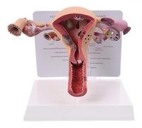 Generico Sistema riproduttivo femminile Modello di utero umano 3D Modello di ovaia dell'utero, sistema riproduttivo femminile, per l'apprendimento didattico, strumento di visualizzazione