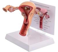 Generico Sistema riproduttivo Femminile Modello di Utero Umano 3D Modello di ovaio dell'utero, Sistema riproduttivo Femminile, per l'apprendimento didattico, Strumento di visualizzazione