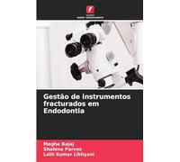 Gestão de instrumentos fracturados em Endodontia