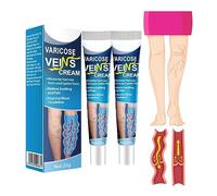 GFOUK - Crema di mucopolisaccaride polisolfato, trattamento per le vene varicose, per gambe, cura delle vene, crema sbiadita per migliorare la circolazione sanguigna, lenire il gonfiore (2 pezzi)
