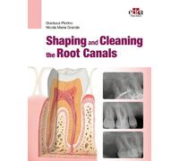 Gianluca Plotino Nicola Maria Shaping and Cleaning the Root Canal (Tascabile)