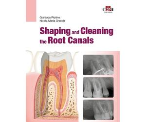 Gianluca Plotino Nicola Maria Shaping and Cleaning the Root Canal (Tascabile)