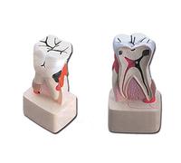 GIMA - MODELLO PATOLOGIA DENTALE