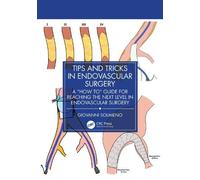 Giovanni Solimeno Tips and Tricks in Endovascular Surgery (Tascabile)