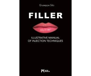 Giuseppe Sito Filler (Copertina rigida)