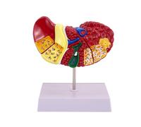 Giwnhvx Modello Di Fegato Di Anatomia Umana per Patologie Comuni, Modello Di Fegato Modello Di Anatomia Ufficio Medico Di Anatomia Umana