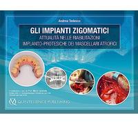 Gli Impianti Zigomatici. Attualità nelle Riabilitazioni Implanto-Protesiche dei Mascellari Atrofici