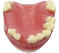 Glixoft Modello di Pratica di Impianto Dentale con Gengive Morbide Modello di Denti Orali Modello di Anatomia Dentale Aiuto Educativo Medico per L'insegnamento Dentale
