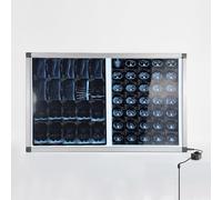 GNbow Illuminatore per Pellicole A Raggi X LED, Negativoscopio Portatile per Pellicole a LED per Ortopedia Dentale, Negativoscopio Portatile per Pellicole Radiografiche Ortopediche e Dentali