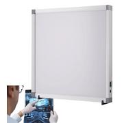 GNbow X-Ray Film Illuminator Light Box, Negativoscopio Portatile per Pellicole a LED per Ortopedia Dentale, Negativoscopio Portatile per Pellicole Radiografiche Ortopediche e Dentali
