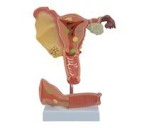 GPDNBIEU, Modello di utero patologico, for la dimostrazione didattica della ricerca sulla comunicazione medico-paziente