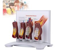 GPDNBIEU, Modello didattico sull'occlusione dei vasi sanguigni, dimostrazione dell'allargamento, for la didattica medica