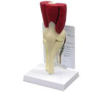 GPI Anatomicals 1060 Modello di Ginocchio con Muscoli