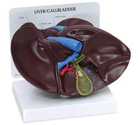 GPI Anatomicals 3300 Modello di Fegato/Cistifellea con Calcoli Biliari