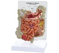 GPI Anatomicals 3342 Modello di Tratto Gastrointestinale