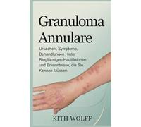 Granuloma Annulare: Ursachen, Symptome, Behandlungen hinter ringförmigen Hautläsionen und Erkenntnisse, die Sie kennen müssen